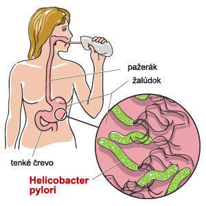 NaturMedic PYLOX - Helicobacter pylori 10 vrecúšok